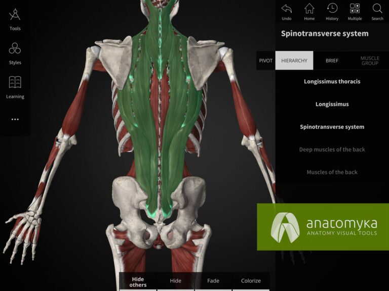 Anatomyka multiple selection